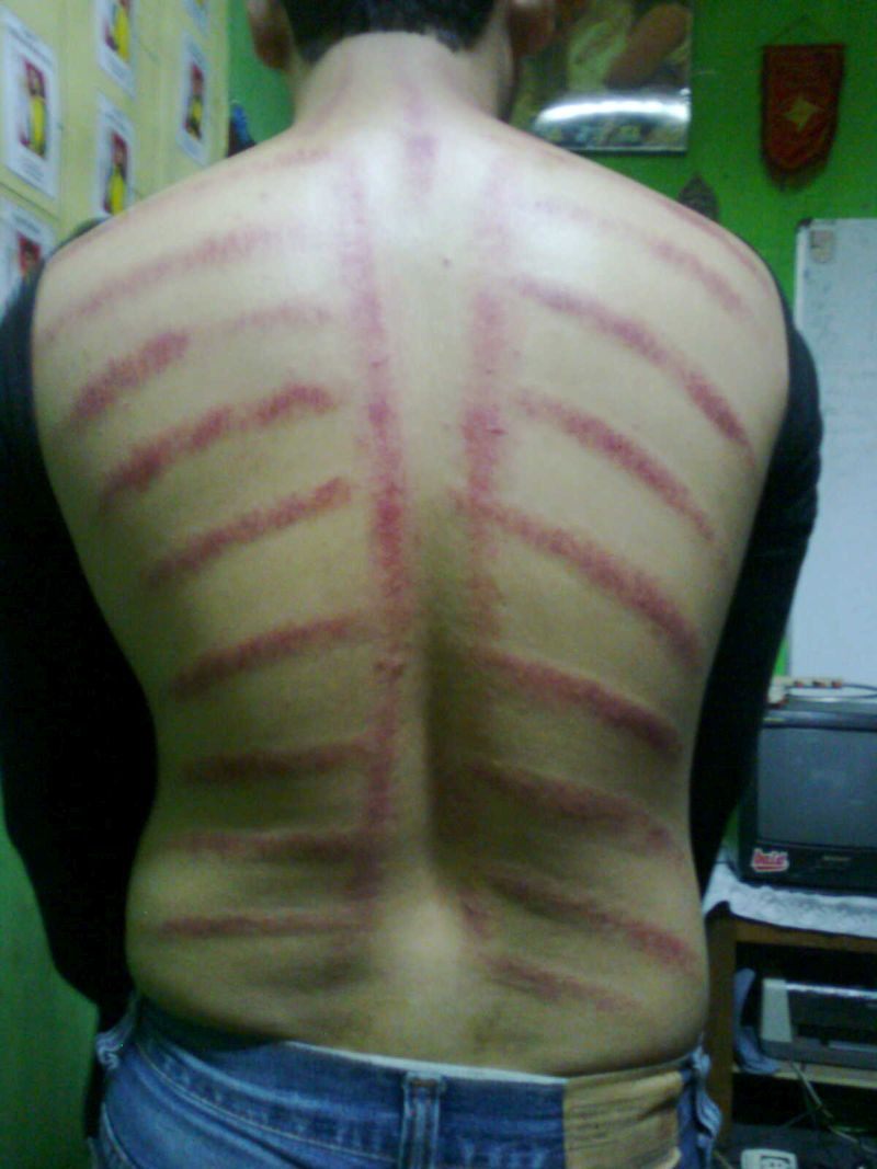 After Kerok